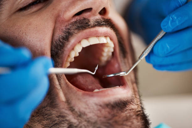 Best Emergency Root Canal Treatment in North Wildwood, NJ
